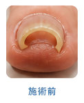 施術前